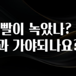 기다렸던 정보 이빨이 녹았나? 치과 가야되나요? 궁금하시죠?