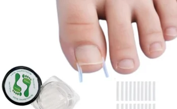 올해 베스트 내성발톱교정기 아주 좋은 정보입니다